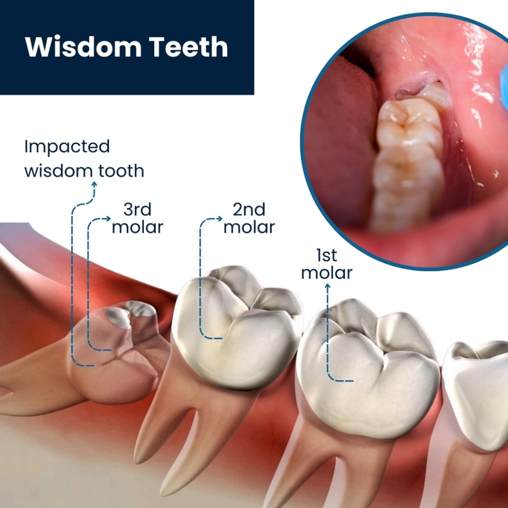 Oral Surgery
