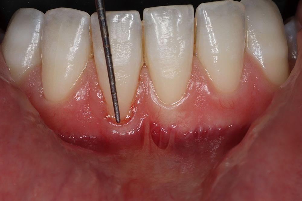 Periodontics